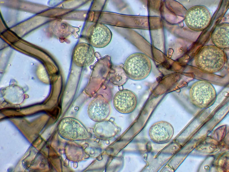 Botryobasidium robustius 3 - Conidióforos-006